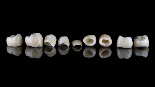 CEREC Crowns Compared To Other Restorations