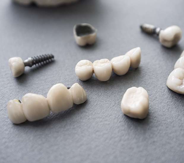 Chattanooga The Difference Between Dental Implants and Mini Dental Implants
