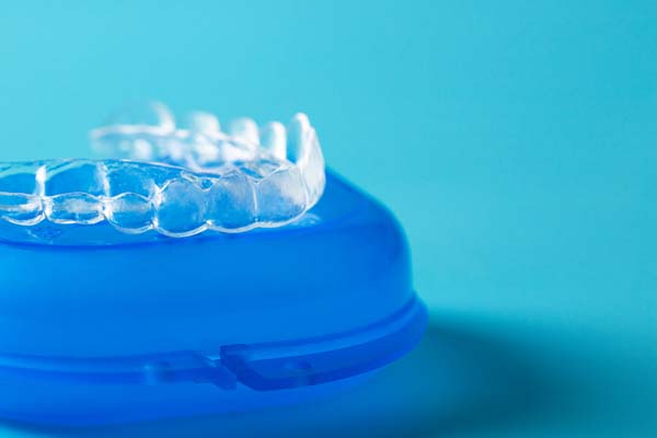 What Are Invisalign Clear Aligners?