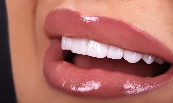 Smile Makeover Plan Options For A Gummy Smile